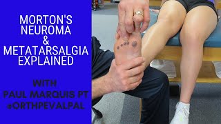 Mortons Neuroma and Metatarsalgia Whats the Difference [upl. by Meraree]