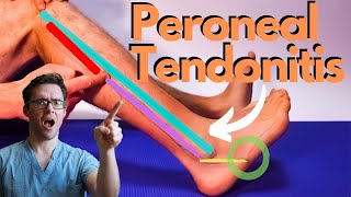 Peroneal Tendonitis Treatment 2024 Peroneus Brevis amp Longus Pain [upl. by Jessey]