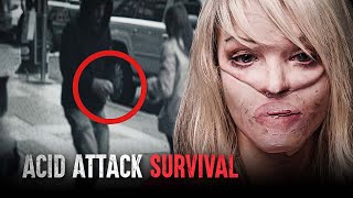 How I Survived an Acid Attack The Katie Piper Story [upl. by Viguerie]