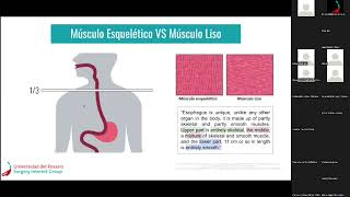 Anatomía del esófago y divertículos esofágicos [upl. by Pelagia]