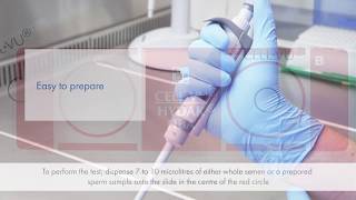 HBA SpermHyaluronan Binding Assay [upl. by Sirron180]