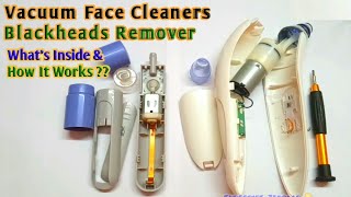 Vacuum BlackHead Remover  Whats Inside amp How It Works [upl. by Roswell]