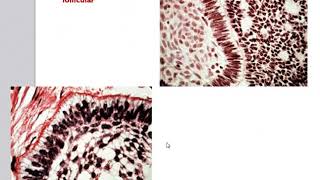 Odontogenic Tumors [upl. by Adla]