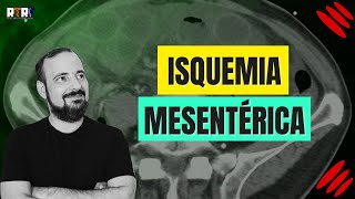 Isquemia mesentérica  José Góes [upl. by Adnarem]