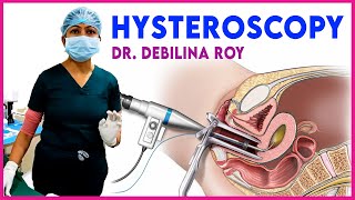 Explaining about hysteroscopy  Our specialist DrDebilina Roy  Iswarya fertility centre Kolkata [upl. by Eterg]