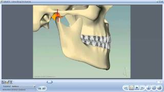 Anterior Guidance [upl. by Naret]