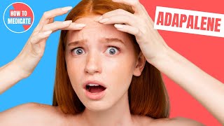 How to use Adapalene Differin Plixda  Doctor Explains [upl. by Selym178]