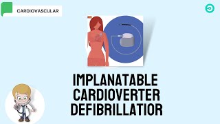 ICD Implantable Cardioverter Defibrillator [upl. by Dorr]