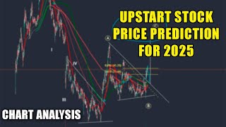 Upstart Stock Price Forecast ShortTerm And LongTerm For 2025 Already Made  With It [upl. by Adnoved]