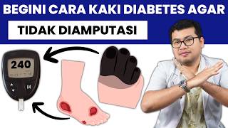 BEGINI KAKI DIABETES YANG BISA DIAMPUTASI  DOKTER SADDAM ISMAIL [upl. by Susumu]