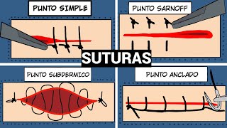 PUNTOS DE SUTURA QUIRURGICA SIMPLE SARNOFF SUBDERMICO Y ANCLADO sutura [upl. by Neddy]