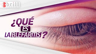 ▶ BLEFARITIS 👀🔥 ¿Qué es esta Enfermedad que provoca Inflamación y Rojez en los párpados [upl. by Zelle]