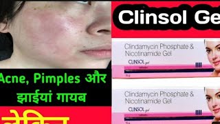 Clinsol gel review  Clinsol gel  Best pimple gel  पिंपल्स के लिए सबसे बेस्ट जेल  क्लिंसोल जेल [upl. by Bena446]