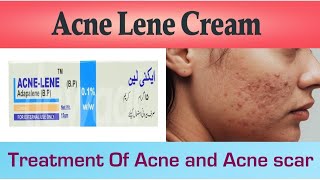 how to treat acne and acne scars with acne lene creamhow to remove pimplesdano ka ilaj [upl. by Cigam]