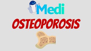 ¿Cuándo tamizar Osteoporosis [upl. by Valerlan]