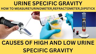 URINE SPECIFIC GRAVITYHOW TO MEASURECAUSES OF HIGH AND LOW SPECIFIC GRAVITYURINE ROUTINE [upl. by Eidorb]