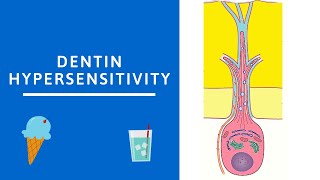 Dentin hypersensitivity Dentin Pulp Complex Session 8 [upl. by Romano685]