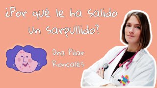 Exantemas o sarpullidos ¿por qué se producen ¿cómo distinguirlos ¿qué debemos hacer [upl. by Cornelle]