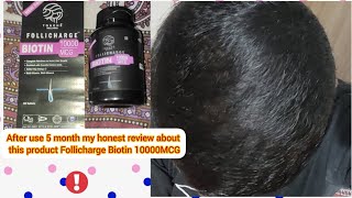 follicharge Biotin 10000mcg Review After use of 5 month Result [upl. by Aylmar]