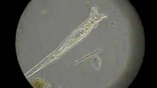 The Happy Rotifer [upl. by Bjork]