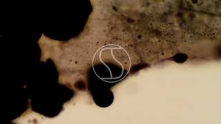 Adipose Tissue under the microscope with Sudan Black stain [upl. by Redd661]