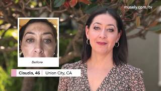 Real customers Real stories Real results  Musely Dark Spot Remover Reviews [upl. by Acissey370]