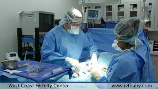 West Coast Fertility Centers Male Infertility Treatments [upl. by Dronski798]