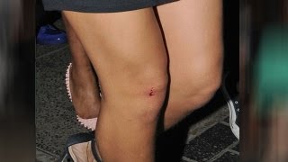 Rihanna injured in London in Paparazzi Brawl [upl. by Meli122]