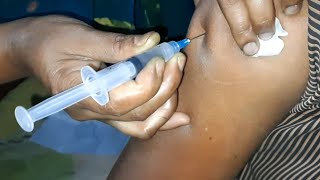 Arm IM Cortson Injection Video Hydrocortisone injection push  24 Ep33 By Injection Media [upl. by Mapel]