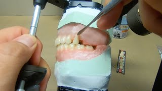 Arranging Teeth for Lingualized Occlusion [upl. by Furtek369]