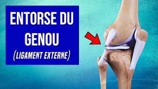 Entorse du genou Ligament Externe  Les Traitements [upl. by Rosenberger286]