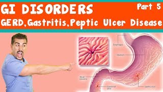 GI Disorders GERD Gastritis peptic ulcer Disease Part 5 [upl. by Calendra]