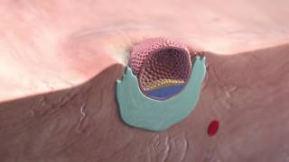 Implantation of the blastocyst [upl. by Rachaba326]