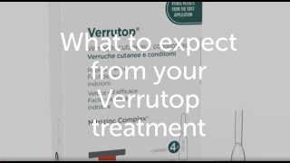 Verrutop Verruca and Wart treatment What to expect at your consultation [upl. by Maxia]