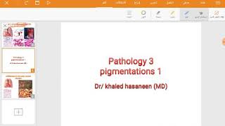 Anthracosis of the lung carbon exogenous pigmentation [upl. by Einapets161]