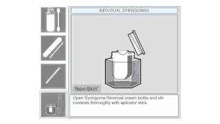 Individual Syringoma Removal at Home [upl. by Win]