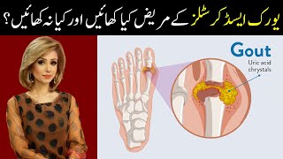 How To Cure Uric Acid Crystals Naturally  Gout Ka Ilaj at Home [upl. by Leamaj672]