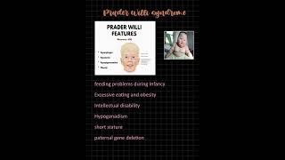 PRADER WILLI SYNDROME MNEMONIC fmge study MBBS [upl. by Clarabelle994]