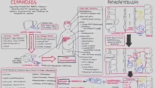 Liver Cirrhosis SandS Pathophysiology Investigations Management [upl. by Miarhpe]