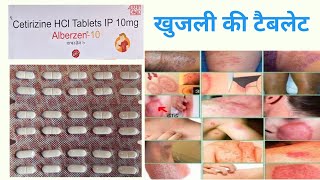 cetirizine tablet use in hindi  खुजली की सबसे अच्छी टैबलेट गारंटी से आराम मात्र दो दिन में [upl. by Aicek]