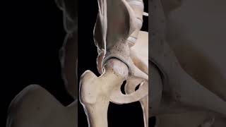 Hip Arthrosis When the Hip Joint Wears Down 🦴📚🥼 medical doctor ortho bone shortvideo video [upl. by Sliwa]