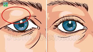 How To Fix Droopy Eyelids Naturally The Results Are Amazing [upl. by Rosalynd432]