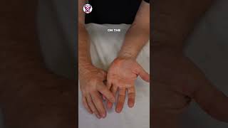 Simple Techniques for Healthy Hands  Dupuytrens contracture [upl. by Dominique895]