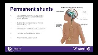 Anesthesia for CSF shunting procedures [upl. by Annalise]