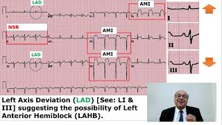 EKG Trainer Case 1 Answer internalmedicine cme usmle محاضراتباطنة ecg [upl. by Beekman]