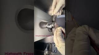 histopathology  epithelialtissue histopathology machine tissueculture patho frozensection [upl. by Shanahan]