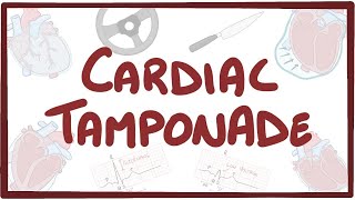 Level 1 Video Lecture Pericardial Effusions and Cardiac Tamponade [upl. by Gniw]