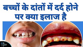 क्या दूध के दांत में RCT करना सही है  Pain and Its treatment in Milk Teeth  Dr Lahna Singh [upl. by Theodora]