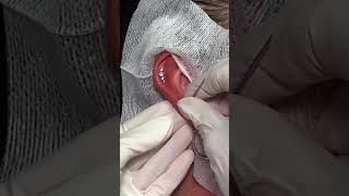 TRIGGER NEEDLE Wedding Inspired Ear Piercings using Base Laboratories Hypochlorous Acid Spay [upl. by Demb]