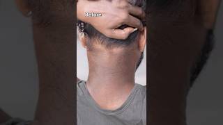 Remove Neck Darkness At Home In 5min  Neck Cleaning Tips  Dark Neck Remove Home Remedies shorts [upl. by Aniretak269]